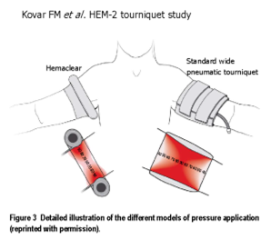 【生理學(xué)和生物學(xué)】Never compression and pain in human volunteers with narrow vs wide tourniquets
